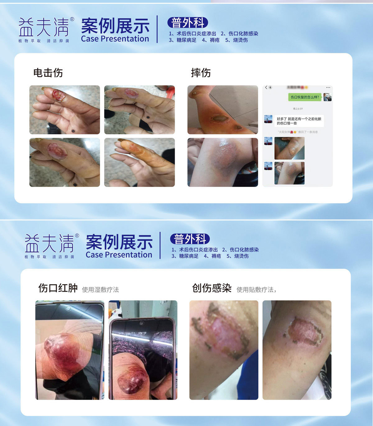 ������ݣ�Ȫ�ݣ��t(y��)ˎ���޹�˾_����