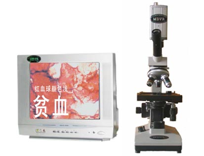 һ��Ѫ�z�y(c��)�x