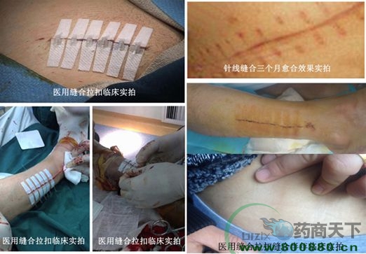 һ����Ƥ�w�p����