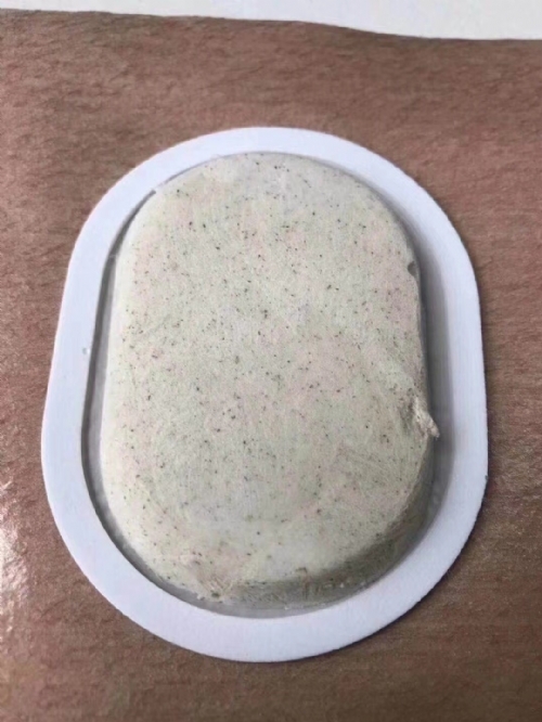 ��������ˎ�I(y��)�Ƽ����޹�˾-ɳ����͸Ƥ�N͸Ƥ����Ѩλ�N���a�S��